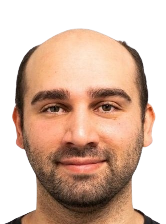 DropMyHair ohne Haartransplantation Ohne Haartransplantation Mönchengladbach