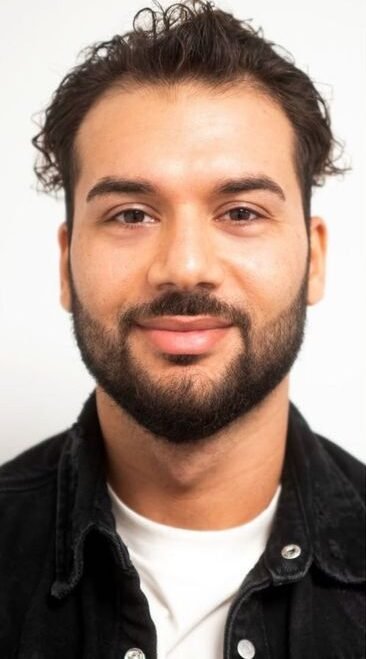 Vor der Haartransplantation DropMyHair Mönchengladbach